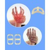 YUYUZSEN 6pcs Oval Finger Splint,Trigger Finger Splint Finger Support Finger