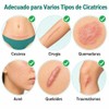 Parches Silicona Cicatrices Láminas Reutilizables Cesárea Acné
