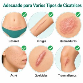 Parches Silicona Cicatrices Láminas Reutilizables Cesárea Acné