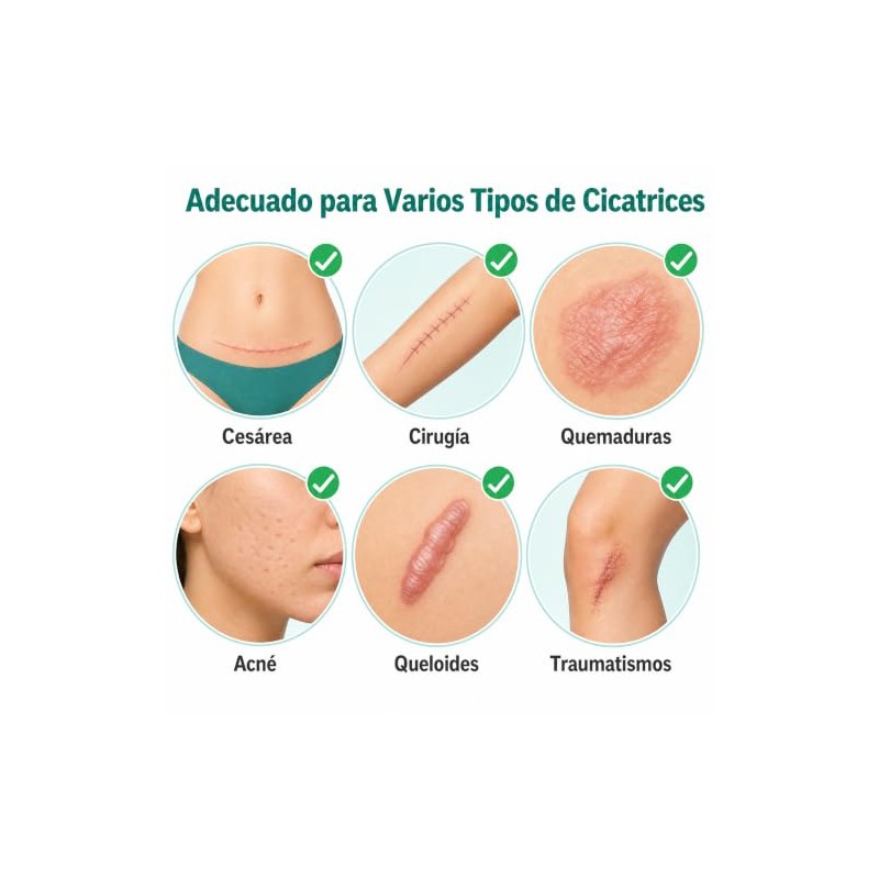 Parches Silicona Cicatrices Láminas Reutilizables Cesárea Acné