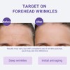 Forehead Wrinkle Patches, Sufchin Face Lift Tape for Wrinkles Overnight