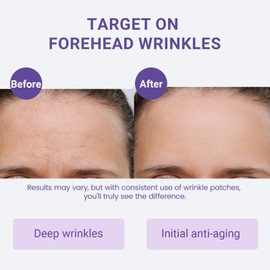 Forehead Wrinkle Patches, Sufchin Face Lift Tape for Wrinkles Overnight Sweatproof & Hypoallergenic, Anti Wrinkle and Beauty Faical Skincare, Visible Lift & Deep Crease Care for Sensitive Skin 20 Pcs