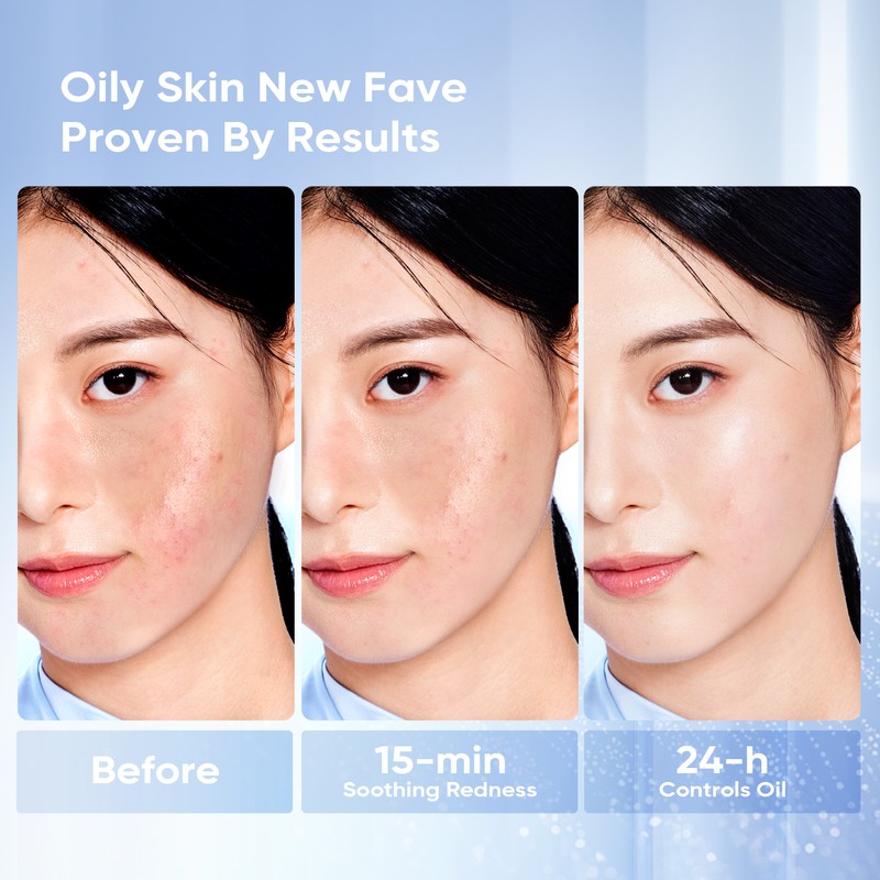 SKINTIFIC <NEW LAUNCH>SKINTIFIC 5X Ceramide Barrier Moisture Gel - Light