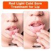 Red Light Cold Sore, Cold Sore Treatment Device, Red Light