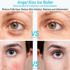 Angel Kiss Ice Roller for Face and Eye - Reduces Swelling, Migraines, Pain and Minor Injuries, Self Care Product, Recommended by Aesthetists with Storage Box