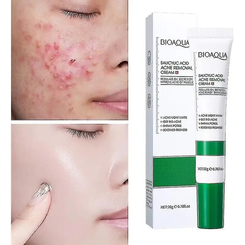 Crema De Ácido Salicílico Para El Control Del Acné Para