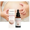 Aceite Estrías Stretchmark Cream Desali Mujeres