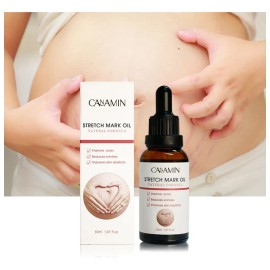 Aceite Estrías Stretchmark Cream Desali Mujeres