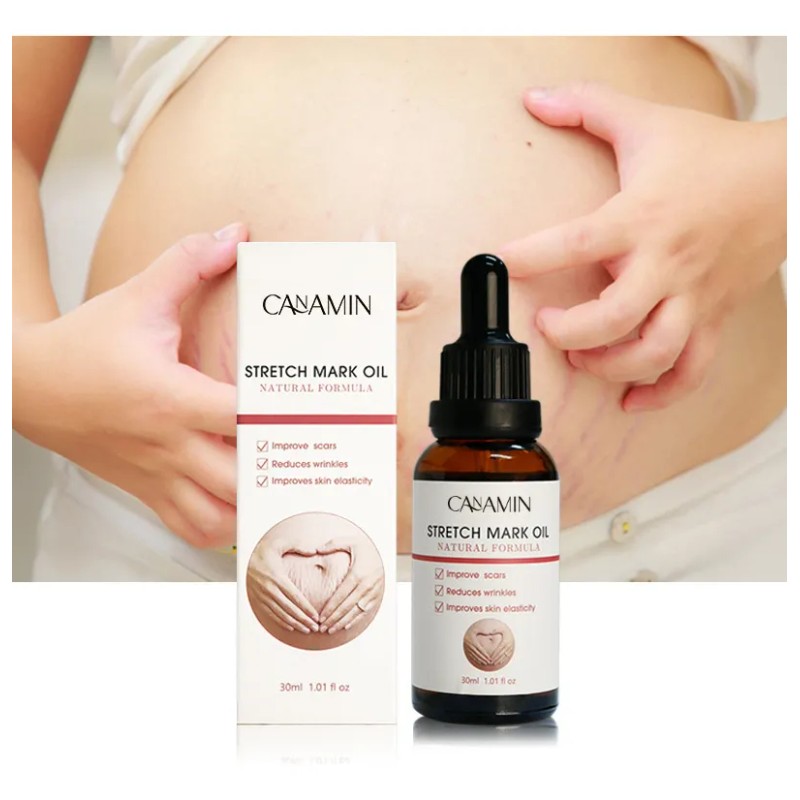 Aceite Estrías Stretchmark Cream Desali Mujeres
