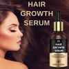 INTIMIFY Hair Growth Serum 30 ml