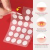 Parches Para Acné Hidrocoloide, Anti Acne Espinillas Granos