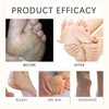 Urea Cream 60 Percent for Feet-Urea Foot Cream Deep Moisturizing