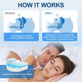 BlessEase Anti-Snoring Mouthpiece, Moldable and Reusable Anti Snoring Mouth Guard, Oral Device to Reduce Snoring, Comfortable Fit for Most of Mouth,Full Set Version: Mild, Moderate, and Severe Snoring