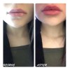 Suero Labios Voluminizador Lipgloss Hidratación Colágeno