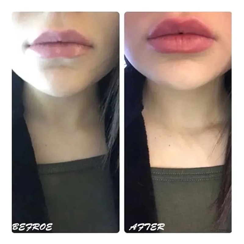 Suero Labios Voluminizador Lipgloss Hidratación Colágeno