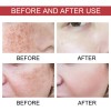 2pcs Suero Corrector De Manchas Oscuras Con Niacinamida