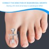 EIH1 Ingrown Toenail Set, Stainless Steel, Nail Corrector, Nail Tool,