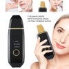 Ultrasonic Skin Scrubber Blackhead Removal Face Cleaning Skin Rejuvenation Machine
