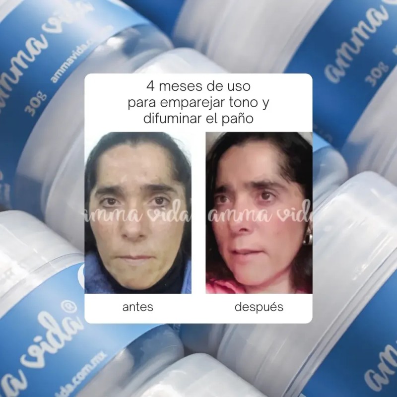 Crema Anti Manchas Amma Vida