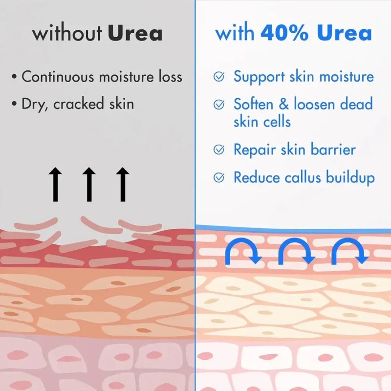 /crema De Urea Ebanel 40% Más De Ácido Salicílico, 2%,
