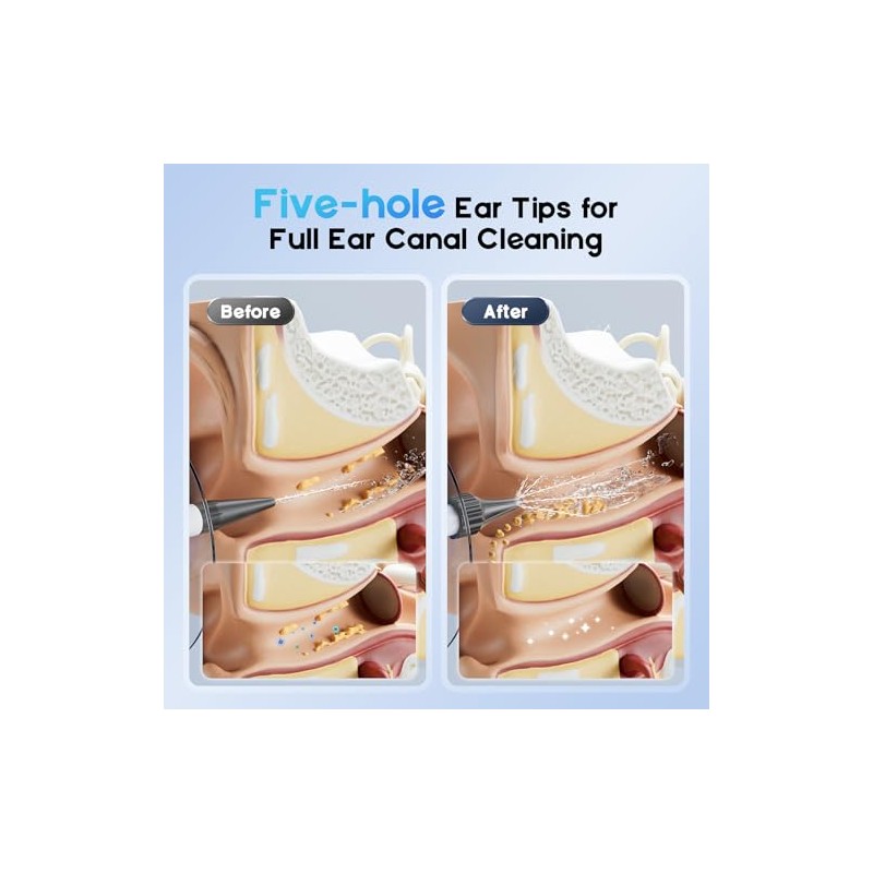 Ear Wax Removal - Ear Cleaner with 4 Pressure Modes,