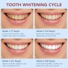 6-1Pack Probiotic Toothpaste SP-6 Whitening Tooth Oral Hygiene Clean Fresh