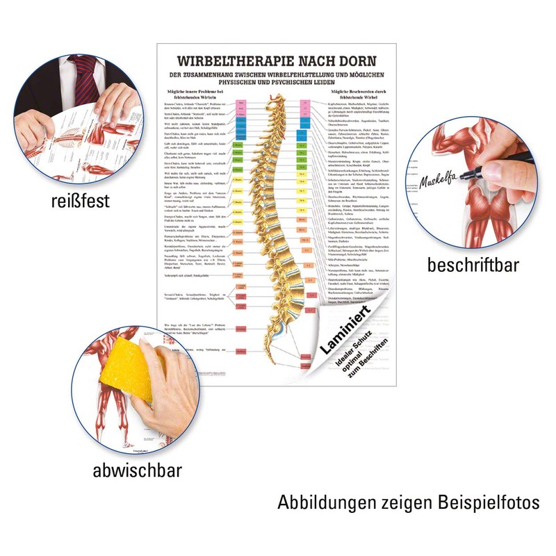 Bolt Mini poster Therapy Medical Educational Anatomy 34x24 cm mittel