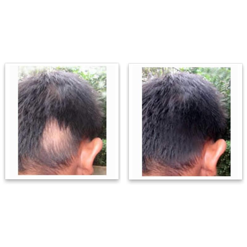 Caboki 10X Hair Powder - Trial Size:_Medium Brown