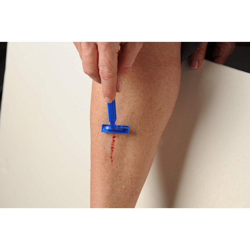 BleedCEASE First Aid for Cuts and Nosebleeds Sterile Packings, 25