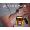 Pomada Natural Para Psoriasis: Hidratación Profunda.