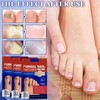 3 Päckchen Zehennagel Behandlung, Nagelgraben Reparaturpflaster, Spaltnagelreparatur Stärkende Nägel, Nagelgraben