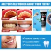 【🔥Special Offer】Activated carbon toothpaste 100g for removing tartar, removing yellow