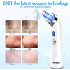 Senelux Blackhead Remover Vacuum Pore Cleaner Acne Comedone Extractor Face