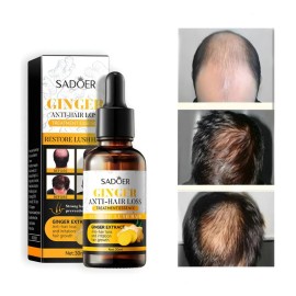 Serum Concentrado Gengibre Natural Crecimiento Cabello 30ml