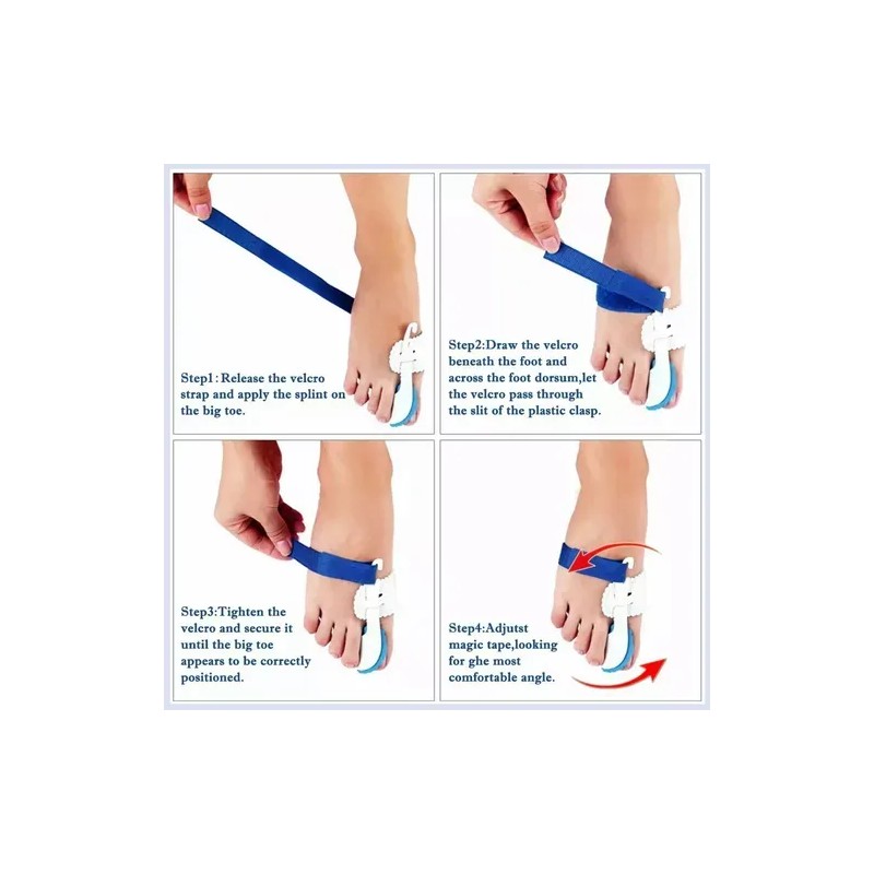 Kit De Correctores De Juanete Y Protectores 11 Pzas Blanco