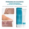 Crema Despigmentante De Manchas Para Cicatrices Paño Acne