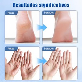 Crema Hidratante Para Pies, Urea Pies, Crema Hidratante Para Pies Resecos，Exfoliante E Hidratante, Elimina Eficazmente Callos Y Piel Gruesa (40 g) (1)