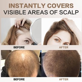 Scattered Hair Medium Blonde, 4 g Roots Powder, Hair Thickening Hair Concealer for Hair Thickening for Women and Men, Wind and Waterproof for Concealing Roots (Medium Blonde)