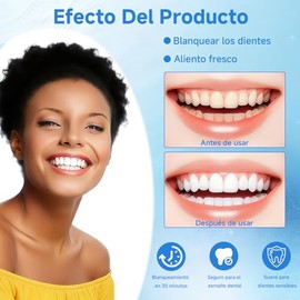 Tiras Blanqueadoras Pzs Pares Elimina Manchas Café Bebidas
