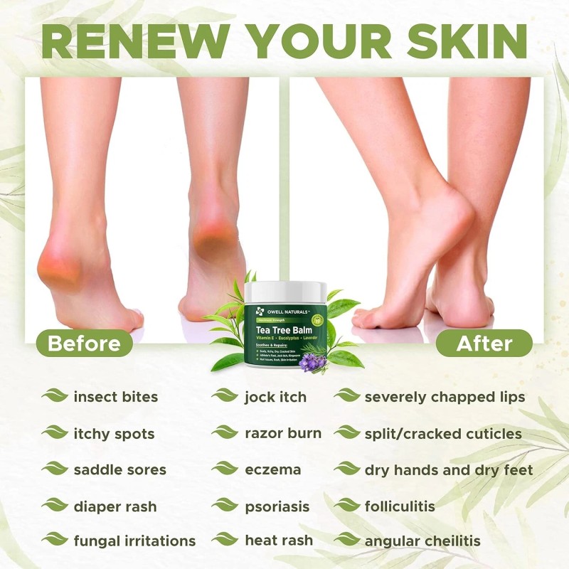 Tea Tree OWELL NATURALS Tea Tree Balm Oil with Vitamin