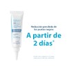 DUCRAY, Keracnyl Glycolic Crema Desincrustante, Disminuye Imperfecciones y Puntos Negros,