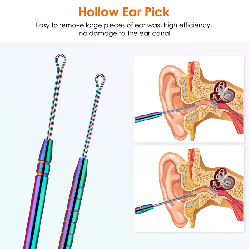 Ear Cleaning Kit,Safe Ear Wax Removal Tool,Earwax Removal Kit,Easy to