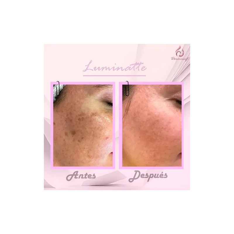 4pack Crema Facial & Corporal Luminatte Aclaradora, Melasma.