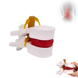 HYEANHLPYE Human Anatomical Lumbar Herniated Model, Portable Lumbar Model, Movable Demonstration of Lumbar Compression, 1.5x Real Time, Medical Demonstration of Lumbar Disc, Educational Aid, White
