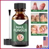 Advanced Strength Solution for Toenail Fungus and Athlete's Foot - Targeting Fungal Infections in Nails