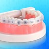 Comfort Covers for Braces - Protector bucal ortodóntico, protector de
