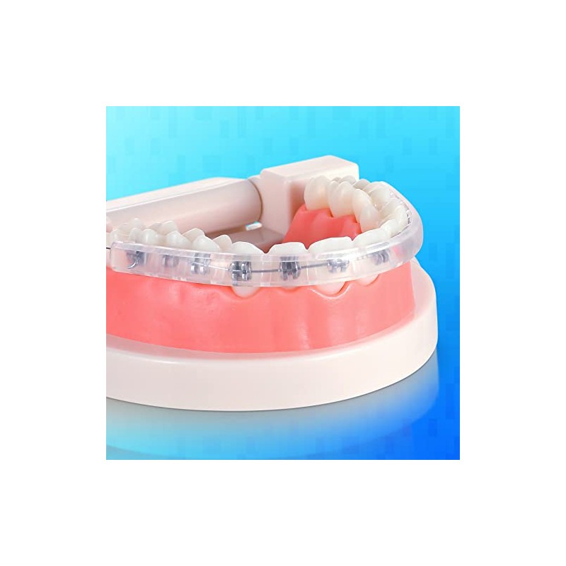 Comfort Covers for Braces - Protector bucal ortodóntico, protector de