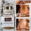 Glitzluxury anti face redness/sun burn cream. Anti malasma. Fast Action