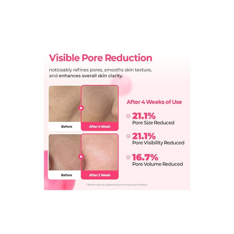 Serum Cemenrete Cyano Pink Spicule Serum 30ml