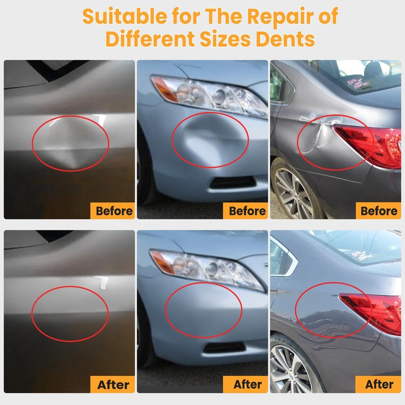 Sigoobal Dent Puller Kit, Paintless Dent Removal Kit with Golden